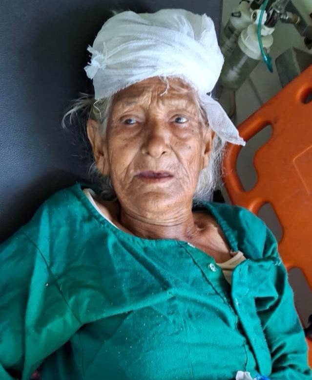 घर में सो रही वृद्धा पर तेंदुवे ने किया हमला, प्राथमिक उपचार के बाद हायर सेंटर रेफेर।